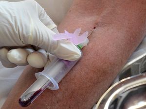 Supporting image for story: Men who have had coronavirus symptoms urged to donate plasma