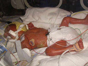 Supporting image for story: Father's fury with Stafford Hospital