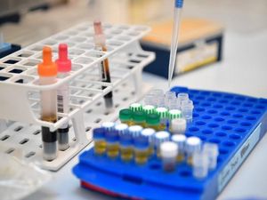 Supporting image for story: New cervical cancer urine test offers hope to more than 29,000 unscreened women across Shropshire