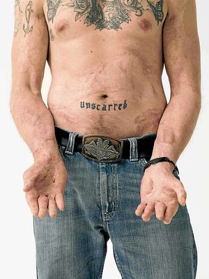 The word unscarred is tattooed across war hero Karl Hinett's stomach