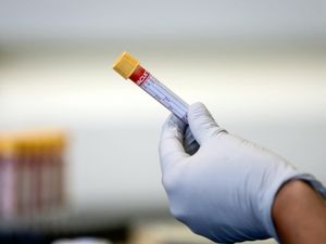 Supporting image for story: Another 14 coronavirus deaths confirmed in region