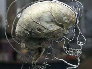 Supporting image for story: ‘Morning people’ linked with higher risk of Alzheimer’s disease