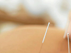 Supporting image for story: Physiotherapy clinic increases resources to cope with demand as NHS works to tackle record backlogs for routine ops