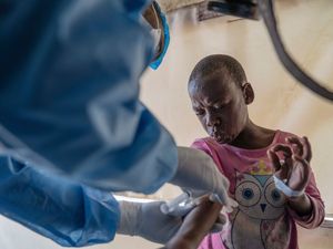 Supporting image for story: WHO grants first mpox vaccine approval to ramp up response to disease in Africa