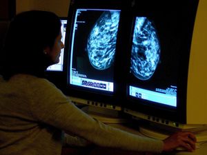 Supporting image for story: Breast screening uptake in Black Country and West Birmingham remains below pre-pandemic levels