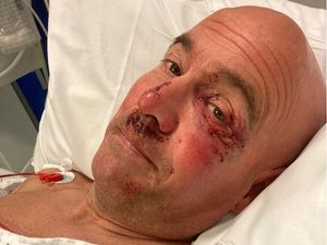 Supporting image for story: Triathlete who suffered serious injuries after cycling over pothole is suing council after finding it still there 15 months on