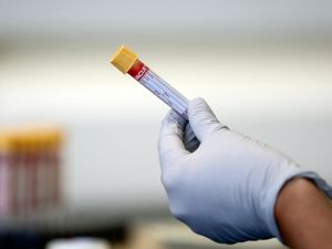 Supporting image for story: Plea to follow lockdown rules to cut virus rate