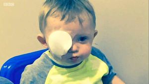 Oscar was blinded in one eye