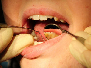 Supporting image for story: Survey gathering views on dental services in Telford and Wrekin