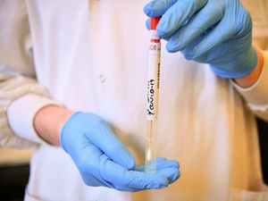 Supporting image for story: Covid-19 ‘may cause cardiac injuries in patients with no known heart conditions’