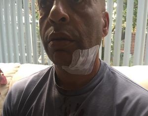 Mr Thompson after hospital treatment