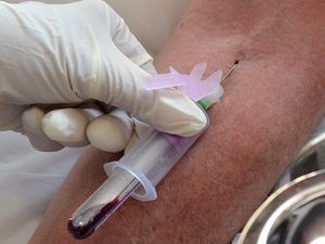 Supporting image for story: DNA blood test could lead to earlier detection of lung cancer