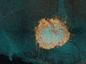 Supporting image for story: White blood cells of immune system can fight Omicron, says new study