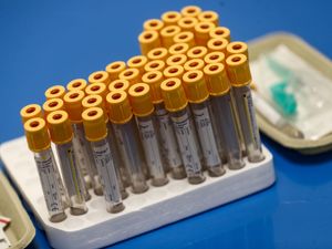 Supporting image for story: Omicron drives US deaths higher than Delta wave