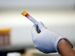 Supporting image for story: One further coronavirus death reported in Shropshire 