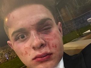 Supporting image for story: Father calls for more police in Newtown after son injured in attack