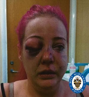 Danielle was left with horrific injuries 