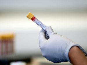 Supporting image for story: Covid infection rates continue to fall in Shropshire