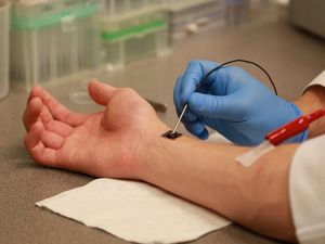 Supporting image for story: This nanochip can repair damaged tissue with just a single touch