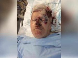 Supporting image for story: Pictured: The serious injuries suffered by a West Bromwich pensioner in a carjacking