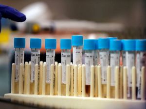 Supporting image for story: Three more Shropshire coronavirus patients die as county death toll reaches 103