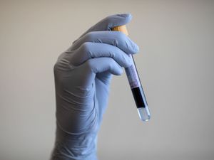 Supporting image for story: NHS to roll out ‘revolutionary’ blood test for lung cancer