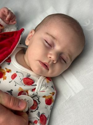 Seven-month-old Darcie Kettle who has a rare genetic condition