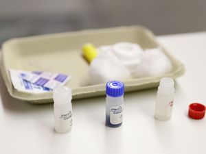 Supporting image for story: Self-testing increases HIV test rate among trans people, study suggests