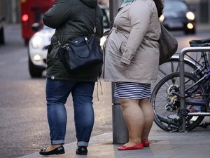 Supporting image for story: Link found between oversized waists and smaller brains