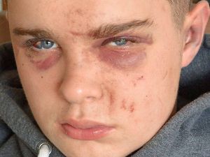 Supporting image for story: Thousands sign petition after paramedic makes plea following attack on teenager
