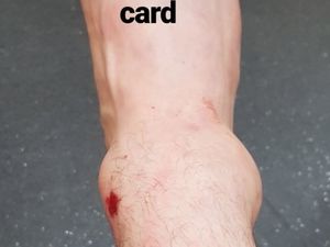 Supporting image for story: Wolves winger Diogo Jota shares image after ankle injury