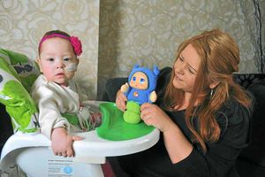 Supporting image for story: Her little body is covered in scars, but she's always smiling