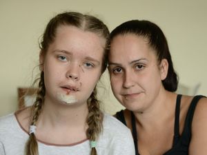 Supporting image for story: 'My daughter could have died': Mother demands dog behind horrific attack is caught