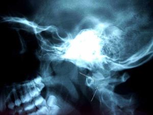 Supporting image for story