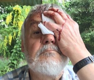 William Edmondson suffered a head wound following a fall