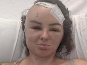 Supporting image for story: Appeal launched to help woman diagnosed with brain tumour after eye test