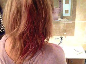 The back of her head was also cut in the attack last November