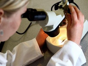 Supporting image for story: Immunotherapy could help advanced bowel cancer patients resistant to drugs