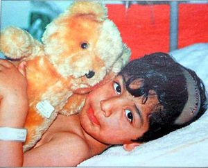 Ahmed Malik recovering in hospital after the attack, with the wound on the top of his head clearly visible