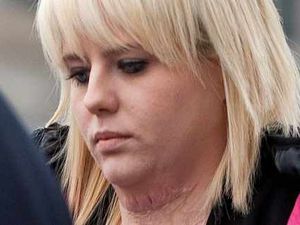 Supporting image for story: Pensioner in acid attack case was 'normal self', court hears