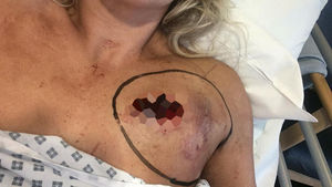 Deena Smith was stabbed in the chest by Martyn Smith