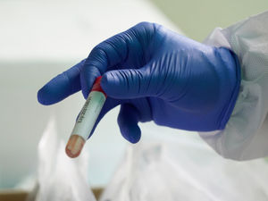 Supporting image for story: Two more Shropshire residents die with Covid as infection rate drops