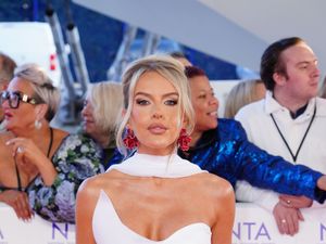 Supporting image for story: Faye Winter tells of ‘terrifying’ weeks before Love Island due to botched Botox