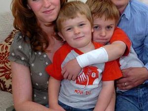 Supporting image for story: Family on holiday attacked by apes