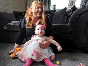 Supporting image for story: Fundraiser to buy wheelchair for little Destiny so she can attend nursery