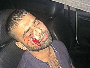 Supporting image for story: Dudley taxi driver left with serious injuries after attack