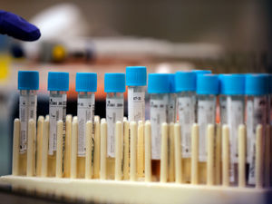 Supporting image for story: Coronavirus outbreak declared as further cases identified at Wrexham food factory