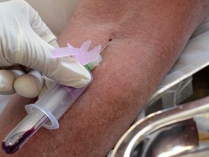 Supporting image for story: Microbe DNA in blood samples could reveal clues about cancer – study