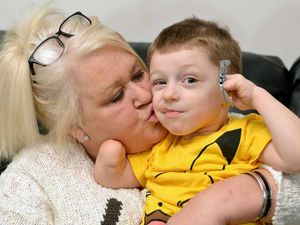 Supporting image for story: West Brom stars pitch in to help five-year-old get new prosthetic limbs