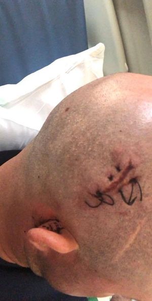 Steve Morris suffered serious injuries in an assault